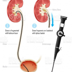 Kidney Hospital