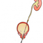 Kidney Hospital