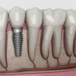 Dental care & implant center