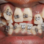 Dental care & implant center